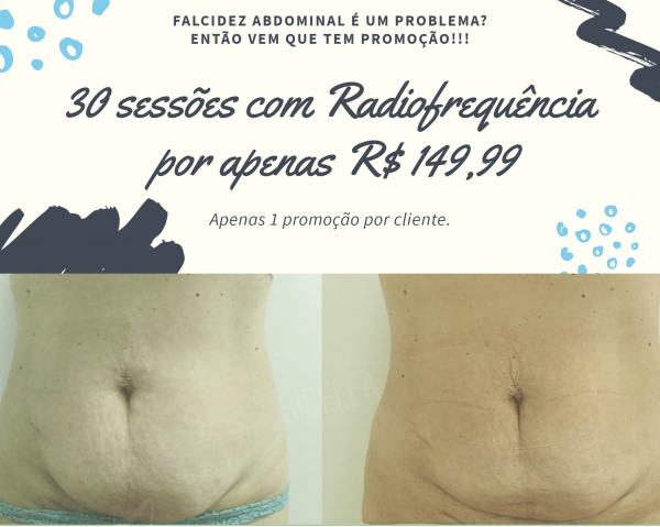 30 sessões com Radiofrequência