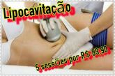 5 Sessões de Lipocavitação