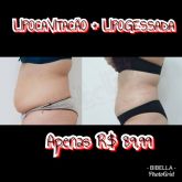 Lipocavitacão + Lipogessada