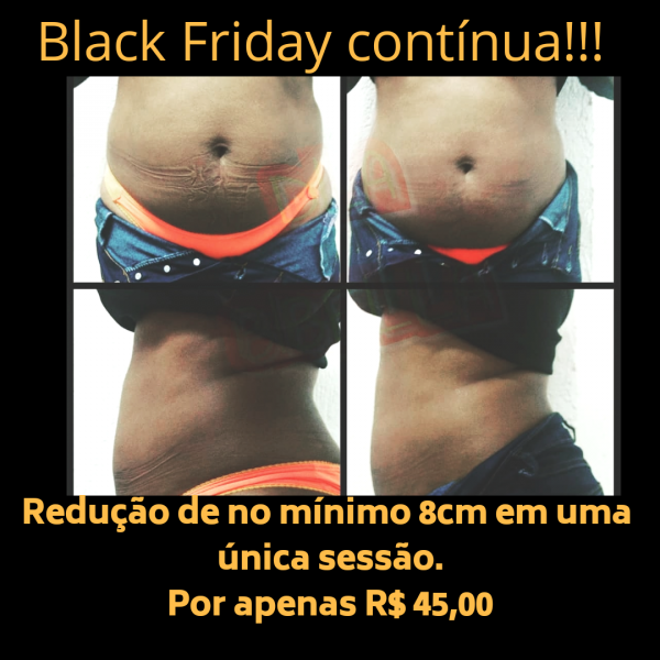 Black Friday ( redução de no mínimo 8cm )