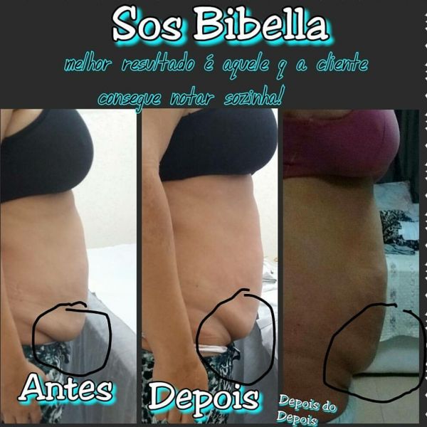 Resultado incrível em uma única sessão... SOS é a solução.