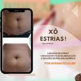 Xô estrias