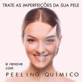 Peeling químico para renovação celular/ clareamento facial