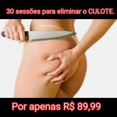 30 sessões para eliminar o Culote .