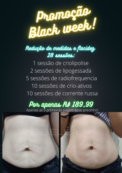 Black week ( pacote com criolipolise)