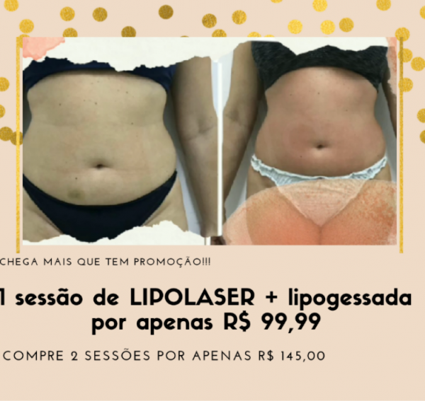 1 sessão de LIPOLASER + lipogessada