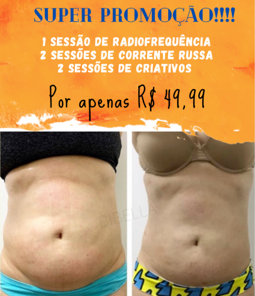 Super promoção com Radiofrequência