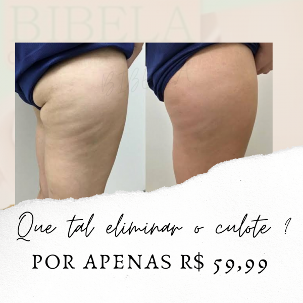 Xô culote