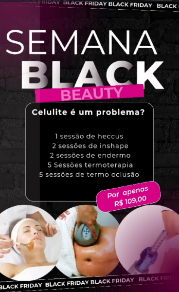 Semana Black beauty( celulite é um problema?)