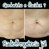 Gordurinha e flacidez? Radiofrequência resolve .