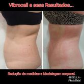 Vibrocell para redução de medidas e Celulite.