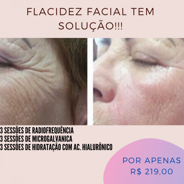 Flacidez facial tem solução!