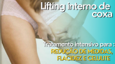 lifting corporal  para eliminar flacidez do interno das coxas