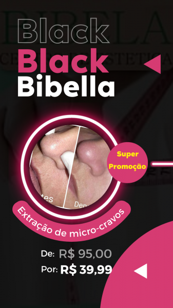 Black Bibella ( extração de cravos )