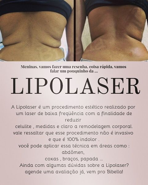 1 sessão de Lipolaser
