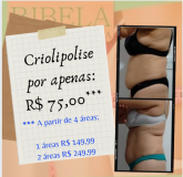 4 áreas de criolipólise