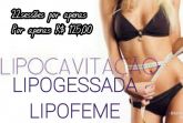 22 sessões com lipocavitação e lipogessada