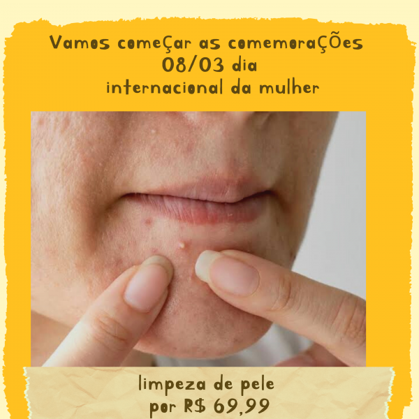 Limpeza de pele com  extração de cravos