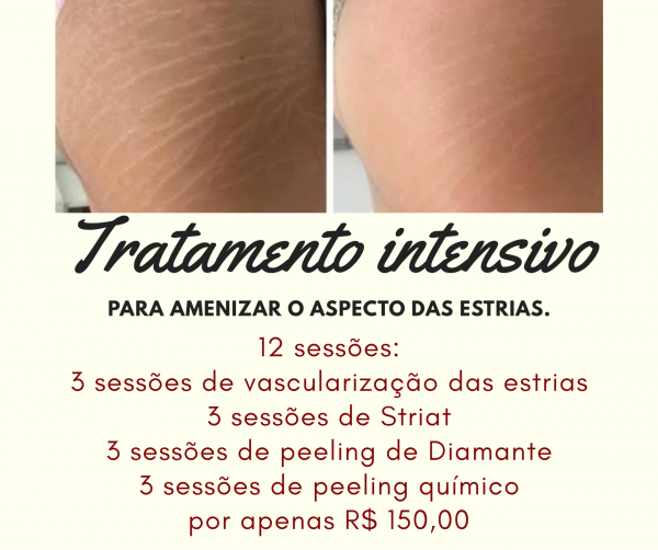 Tratamento intensivo para amenizar as estrias