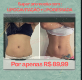 Super promoção para redução de medidas e modelagem corporal