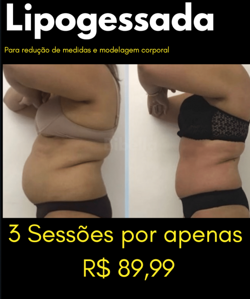 3 sessões de lipogessada