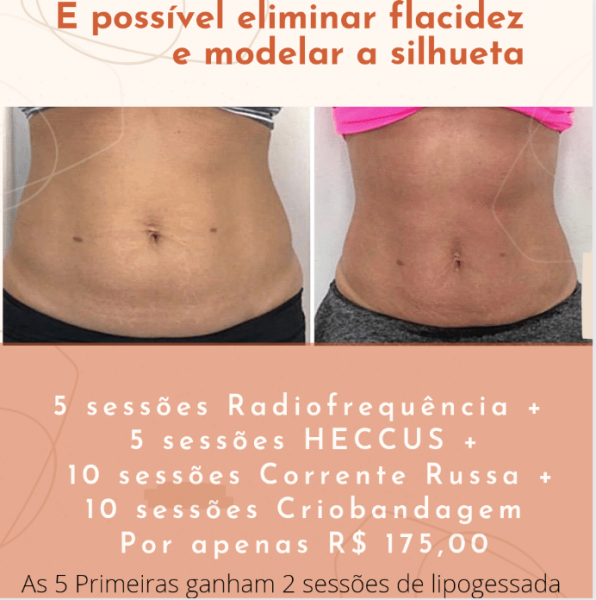 Promoção para eliminar flacidez e modelar a silhueta