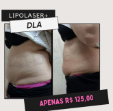 Especial mês da mulher ( DLA + LIPOLASER)