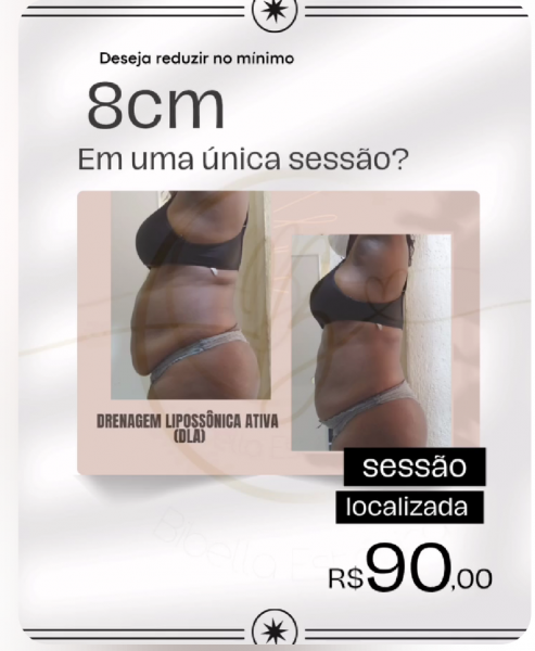 8cm off em uma única sessão