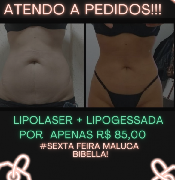 Sexta feira Maluca  ( lipolaser + lipogessada)