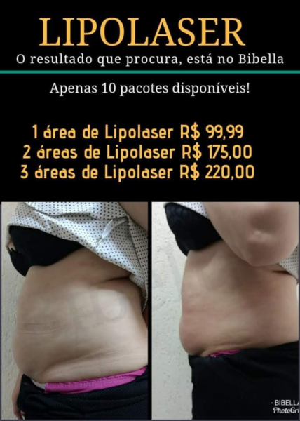 LIPOLASER ( 3 áreas)