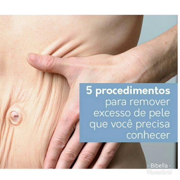 5 procedimentos para detonar o excesso  de pele