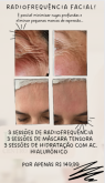 5 sessões de rejuvenescimento facial