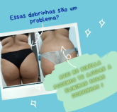 Que tal eliminar as dobrinhas das costas ?