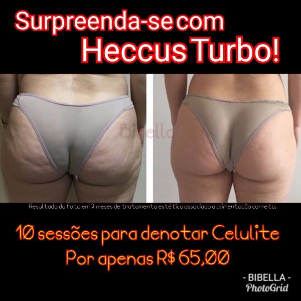 Para Detonar Celulite: Heccus turbo