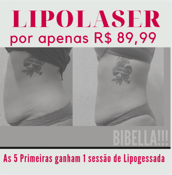 LIPOLASER