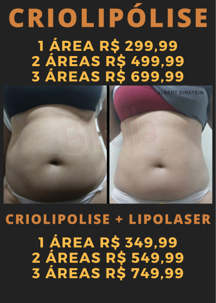 3 áreas de Lipolaser + 3 áreas de CRIOLIPÓLISE