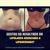 LIPOLASER  + lipogessa