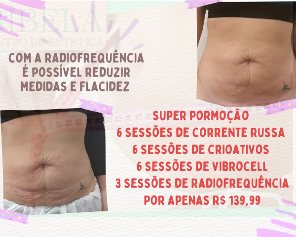 Super promoção redução de medidas e flacidez com  Radiofrequência