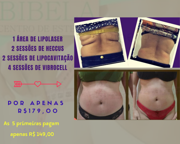 Super promoção com lipolaser