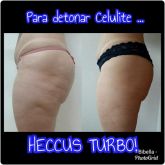 Heccus turbo para detonar Celulite