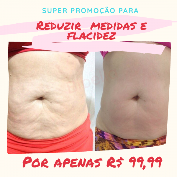 Super promoção para reduzir medidas e flacidez