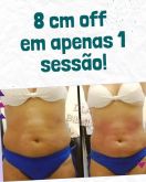 8 cm off em uma única sessão