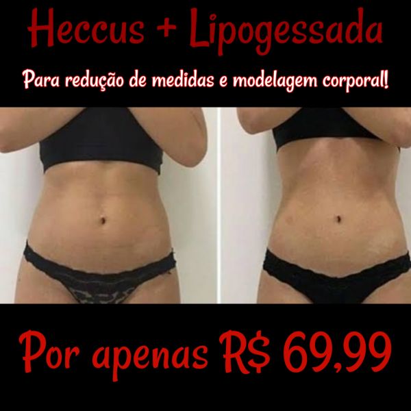 Heccus + lipogessada ( redução de medidas e modelagem corporal)