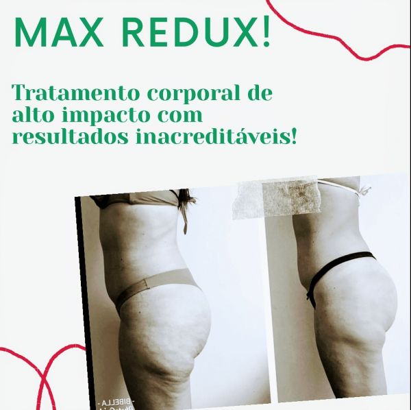 Max Redux ( protocolo para trabalhar anterior e posterior de coxa e o abdômen)