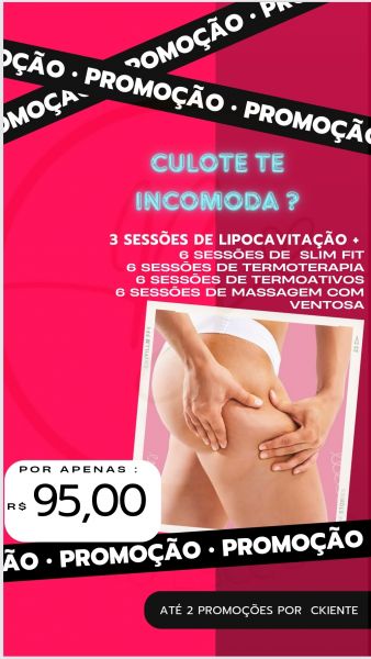 culote te incomoda ?