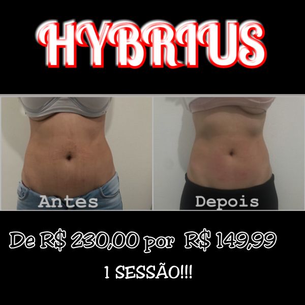 Terapia hybrius. Super tirar 3 em 1.