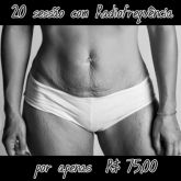 20 sessões com Radiofrequência