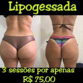 3 sessões de lipogessada