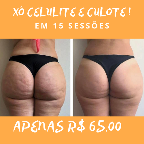 Xô Celulite e culote