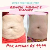 super promoção redução de medidas e flacidez